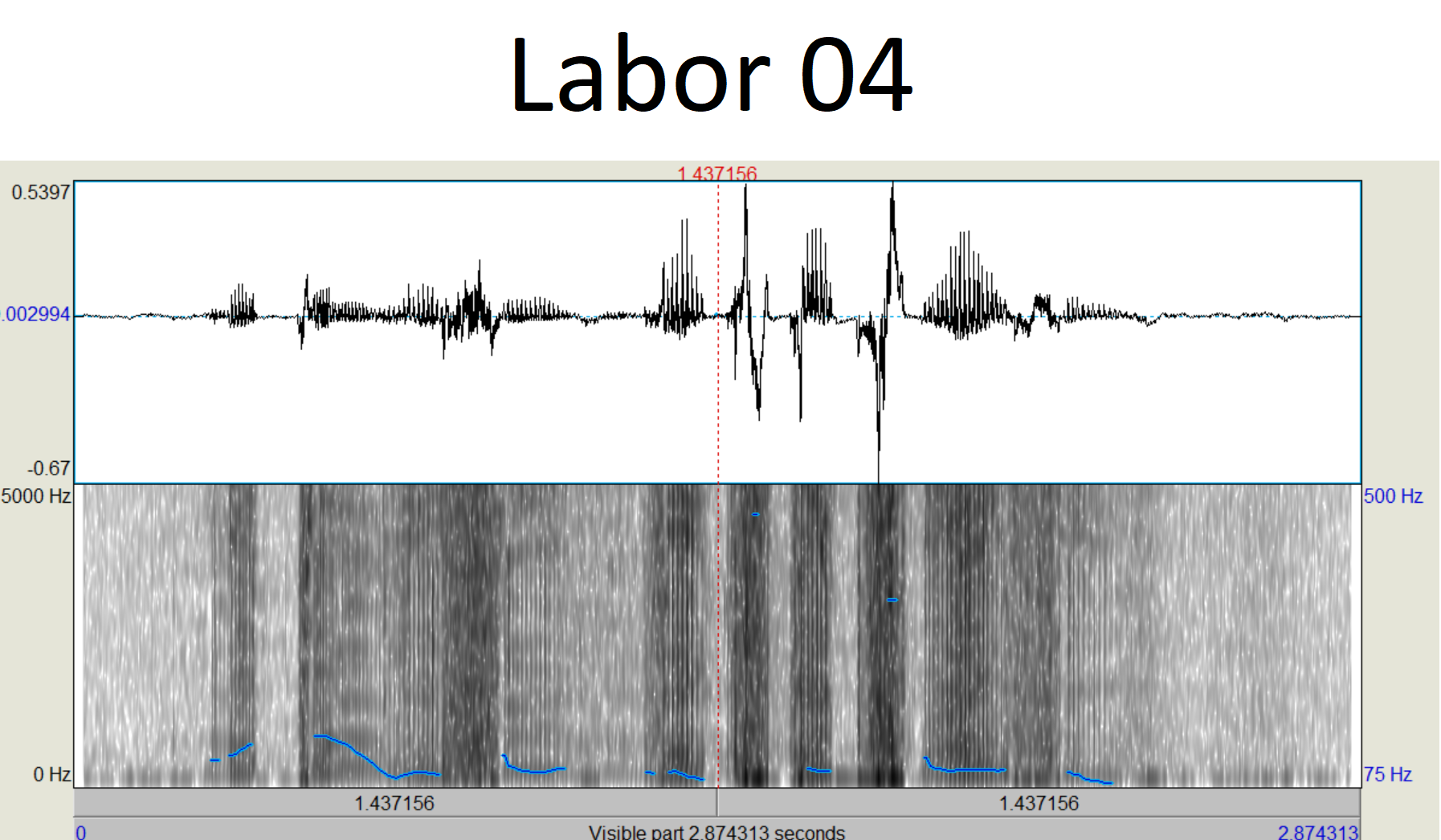 Link zu Labor 03